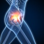 Can Stress Cause Arthritis?