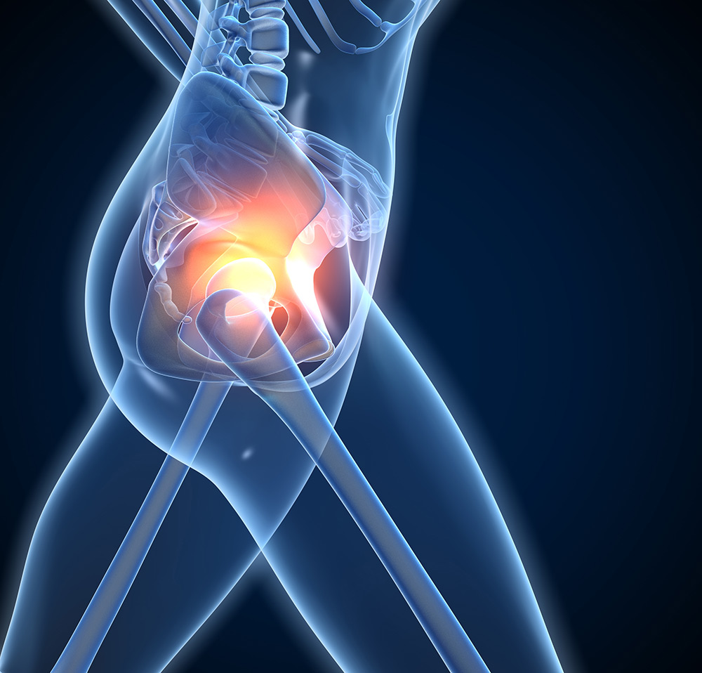 Can Stress Cause Arthritis?
