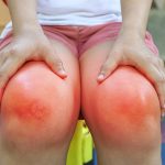 The Link Between Smoking and Rheumatoid Arthritis